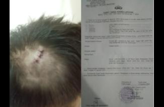 Yoga Manurung Minta Polsek Tanah Jawa: Tangkap JR dan Ebot Termasuk Dalang Pengeroyokan
