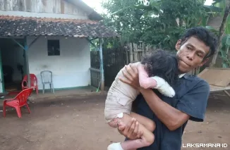 Zulya Ulfa Berjuang Melawan Luka Bakar, Keluarga Harapkan Kepedulian Pemimpin Daerah