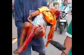 Foto Babi hutan Masuk Kampung dan Serang Dua Korban Anak Kecil Zahlia (4 tahun) dan Orang Tua Misna ( 41 tahun)